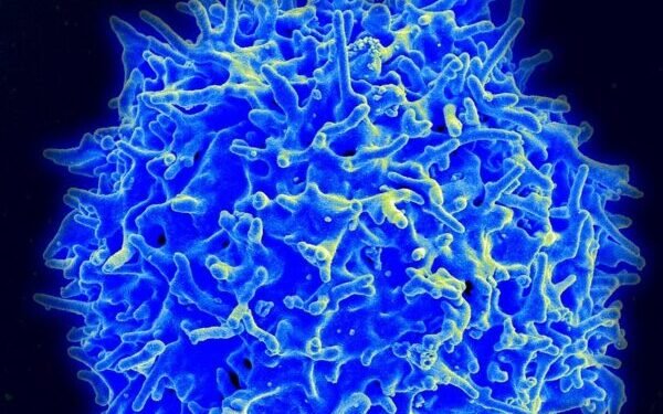 Immunology Startup ai3Bio Aims to Redefine What It Means to Reset the Immune System