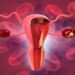 MD Anderson announces new roadmap to eliminate cervical cancer in Texas MD Anderson announces new roadmap to eliminate cervical cancer in Texas
