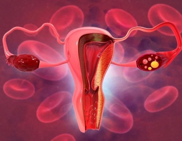 MD Anderson announces new roadmap to eliminate cervical cancer in Texas