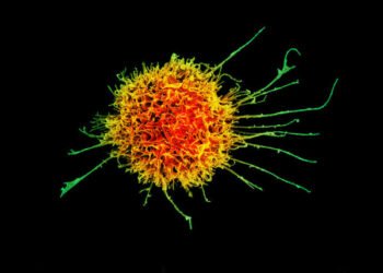 Patient Deaths and Data Shortfall Spell the End for Cell Therapy Biotech Artiva