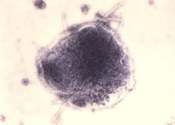 Pennsylvania reports its 6th measles death, in a Franklin County resident