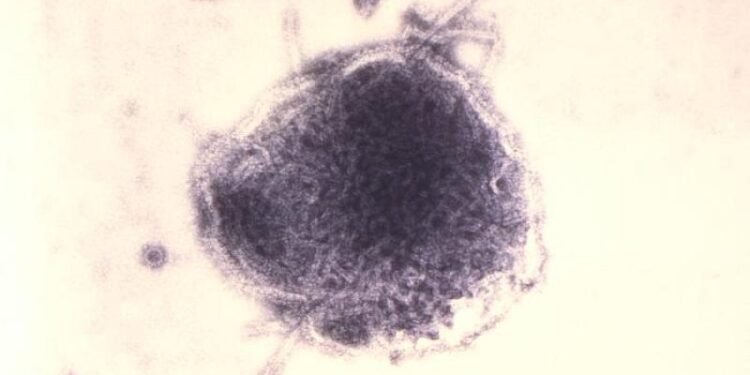 Pennsylvania reports its 6th measles death, in a Franklin County resident Pennsylvania reports its 6th measles death, in a Franklin County resident
