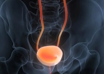 Simple urine test can accurately diagnose and track bladder cancer