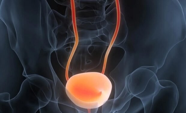 Simple urine test can accurately diagnose and track bladder cancer