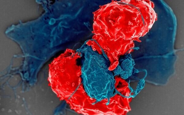 TRrexBio’s IPO Bags 6M to Bring the Immune System Back Into Balance TRrexBio’s IPO Bags 6M to Bring the Immune System Back Into Balance
